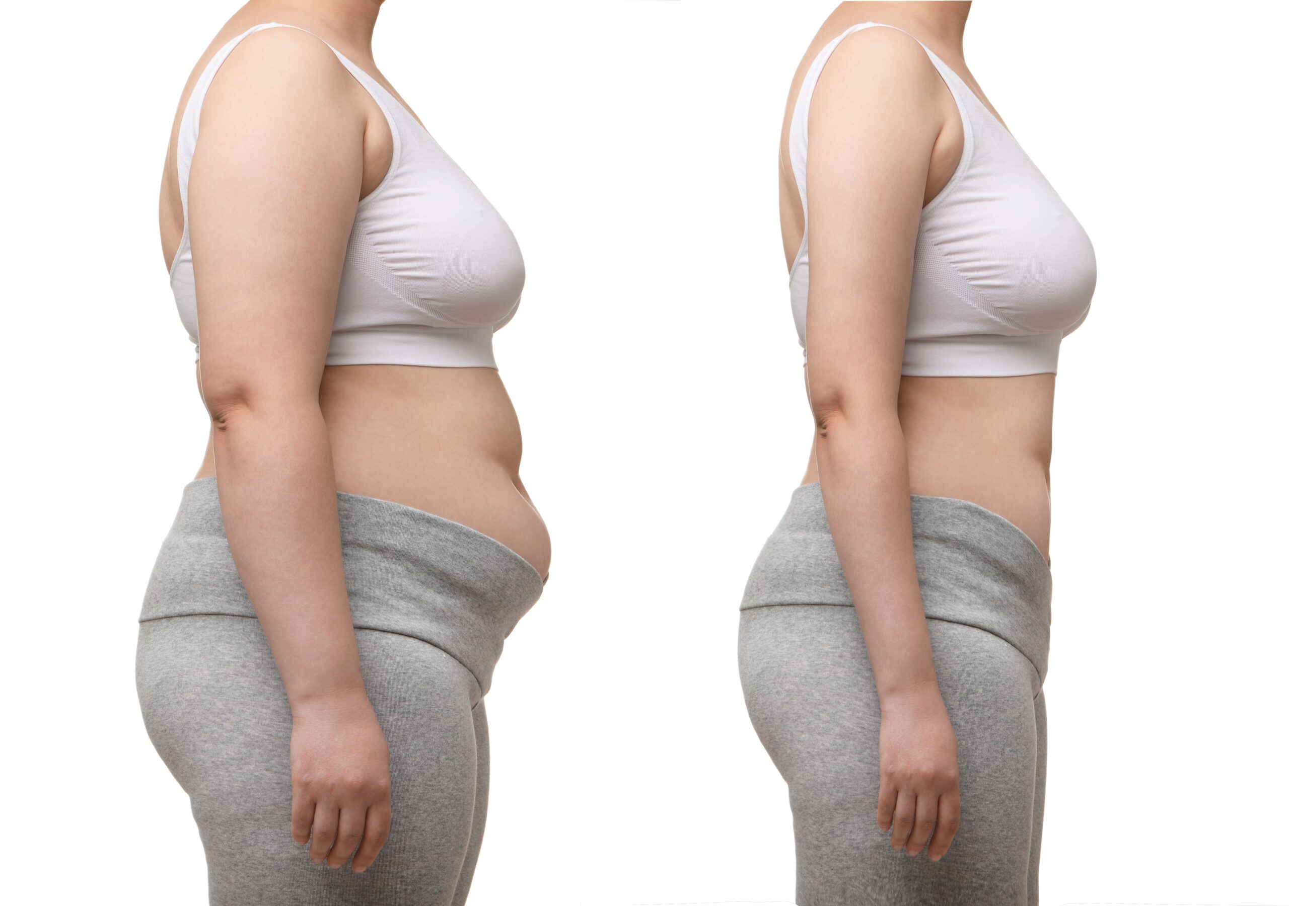 Orlistat before and after